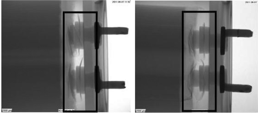 有故障的电容器顶部部件的X射线图像