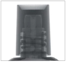 连接件xray检测